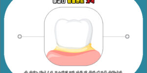 어금니 임플란트 가격